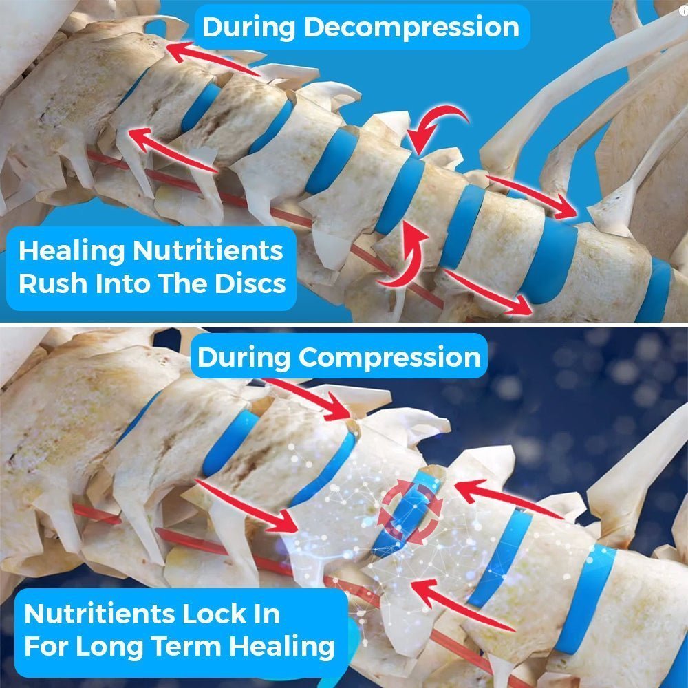 Fisher Traction Neck Traction Device | Fisher Traction